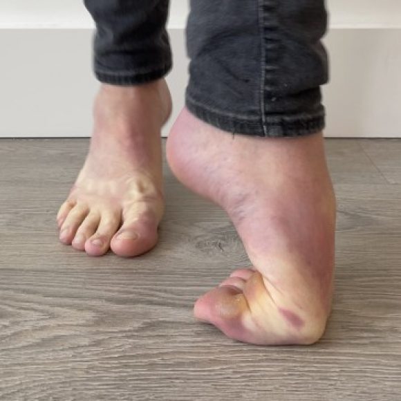 Profile photo of Bendy Feet