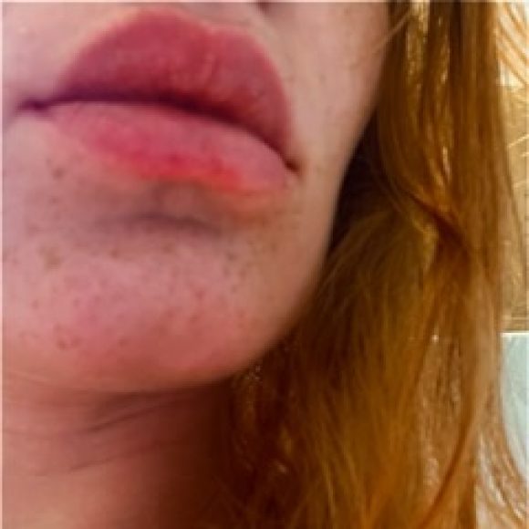 Profile photo of Ginger