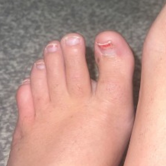 Profile photo of Sweet-feet