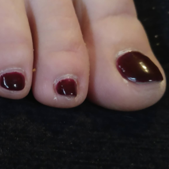 Profile photo of LB Toes