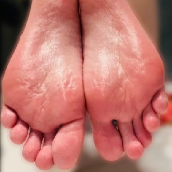 Profile photo of GreasyFeet