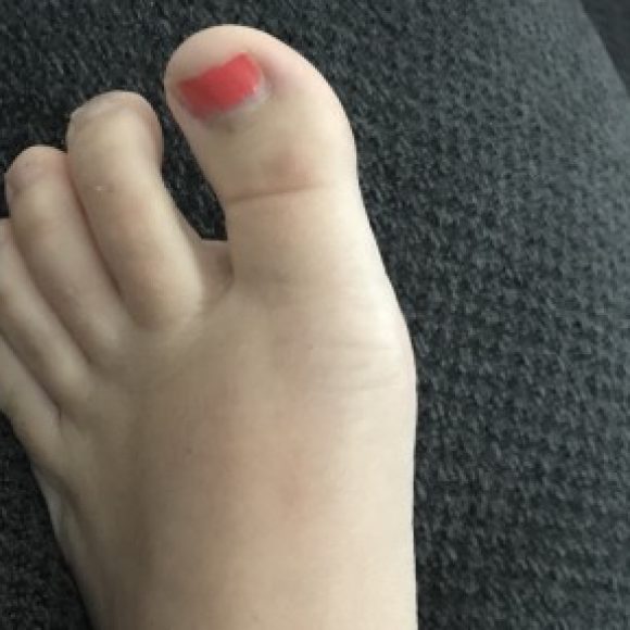 Profile photo of Pretty Feet