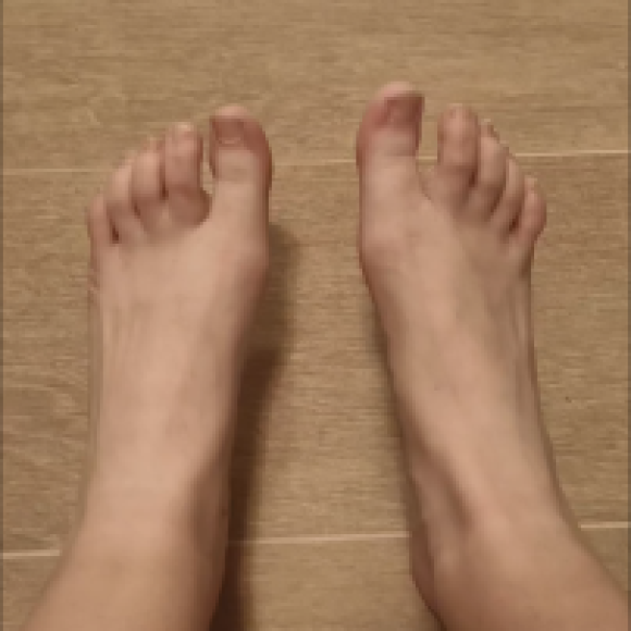 Profile photo of Sweaty Feet
