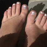 Toes