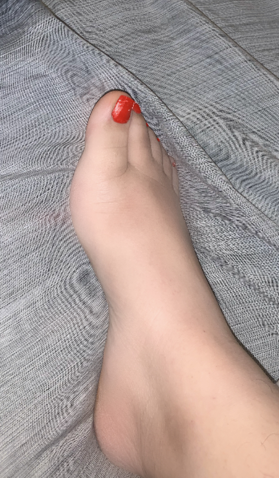 img_4378