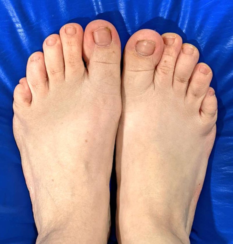 compress_20220124_205458_8593