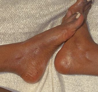 6CA4524E-6EBB-4A98-9A4A-6D00CAD9C19D