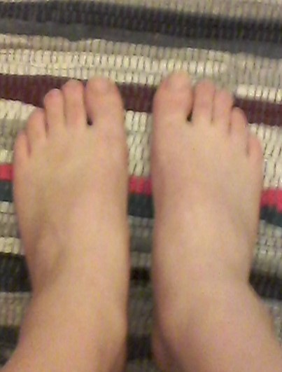feet-101